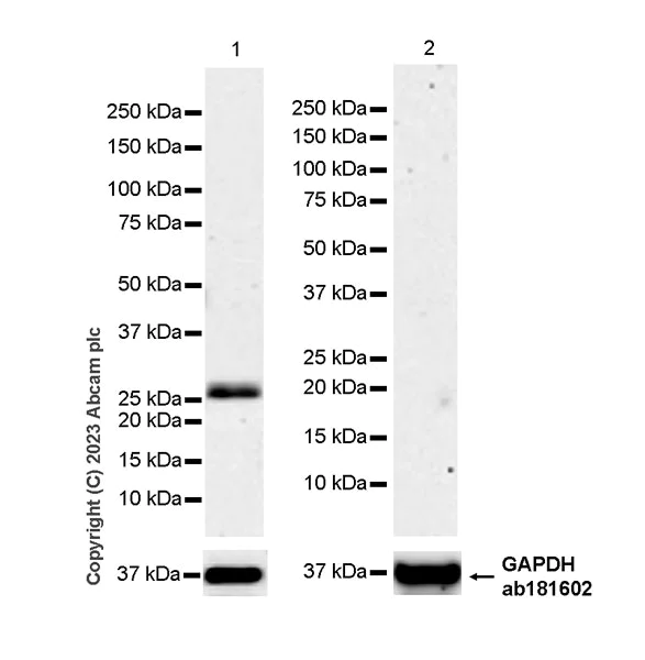 Western blot - Anti-RAB27A + RAB27B antibody [EPR27120-68] (AB313575)