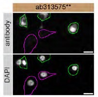 Immunocytochemistry/ Immunofluorescence - Anti-RAB27A + RAB27B antibody [EPR27120-68] - BSA and Azide free (AB313576), expandable thumbnail