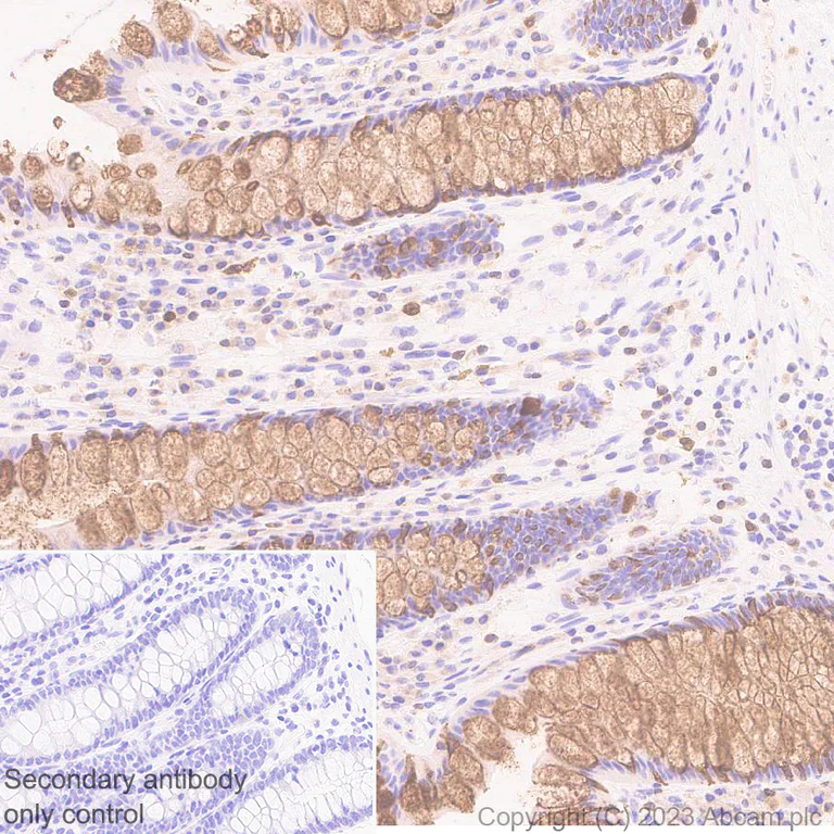Immunohistochemistry (Formalin/PFA-fixed paraffin-embedded sections) - Anti-RAB27A + RAB27B antibody [EPR27120-68] - BSA and Azide free (AB313576)
