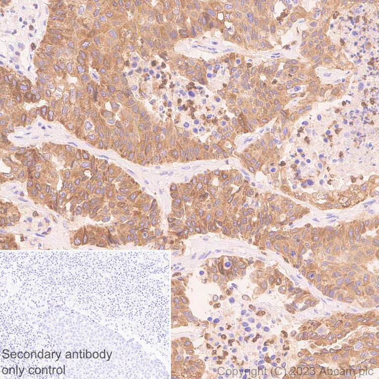 Immunohistochemistry (Formalin/PFA-fixed paraffin-embedded sections) - Anti-RAB27A + RAB27B antibody [EPR27120-68] - BSA and Azide free (AB313576)