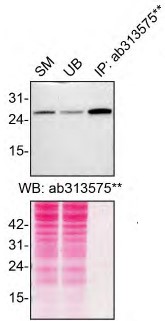 Immunoprecipitation - Anti-RAB27A + RAB27B antibody [EPR27120-68] - BSA and Azide free (AB313576), expandable thumbnail