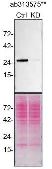 Western blot - Anti-RAB27A + RAB27B antibody [EPR27120-68] - BSA and Azide free (AB313576)