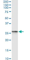 Western blot - Anti-RAB27B antibody (AB103418)