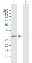 Western blot - Anti-RAB27B antibody (AB103418)