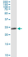 Western blot - Anti-RAB27B antibody (AB103418)