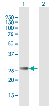 Western blot - Anti-RAB27B antibody (AB76779)