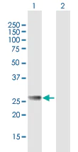 Western blot - Anti-RAB27B antibody (AB76779)