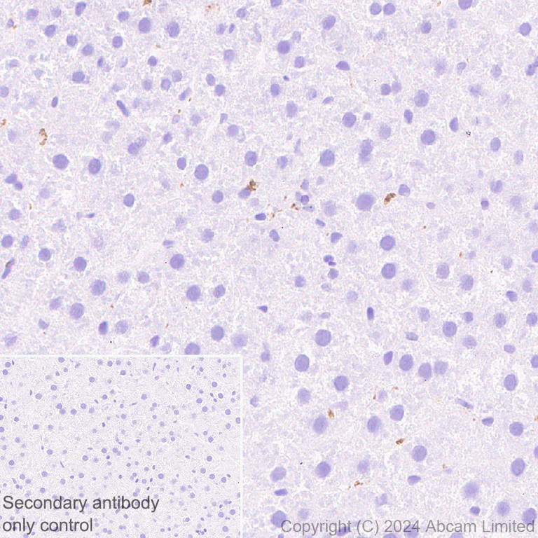 Immunohistochemistry (Formalin/PFA-fixed paraffin-embedded sections) - Anti-RAB27B antibody [EPR28647-29] (AB320640)