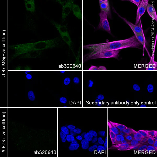 Immunocytochemistry/ Immunofluorescence - Anti-RAB27B antibody [EPR28647-29] - BSA and Azide free (AB320641)