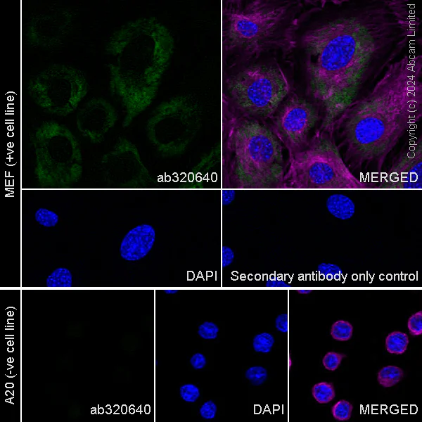 Immunocytochemistry/ Immunofluorescence - Anti-RAB27B antibody [EPR28647-29] - BSA and Azide free (AB320641)