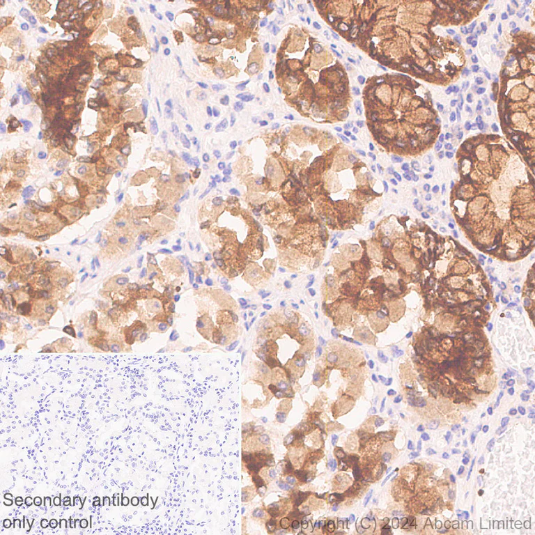 Immunohistochemistry (Formalin/PFA-fixed paraffin-embedded sections) - Anti-RAB27B antibody [EPR28647-29] - BSA and Azide free (AB320641)