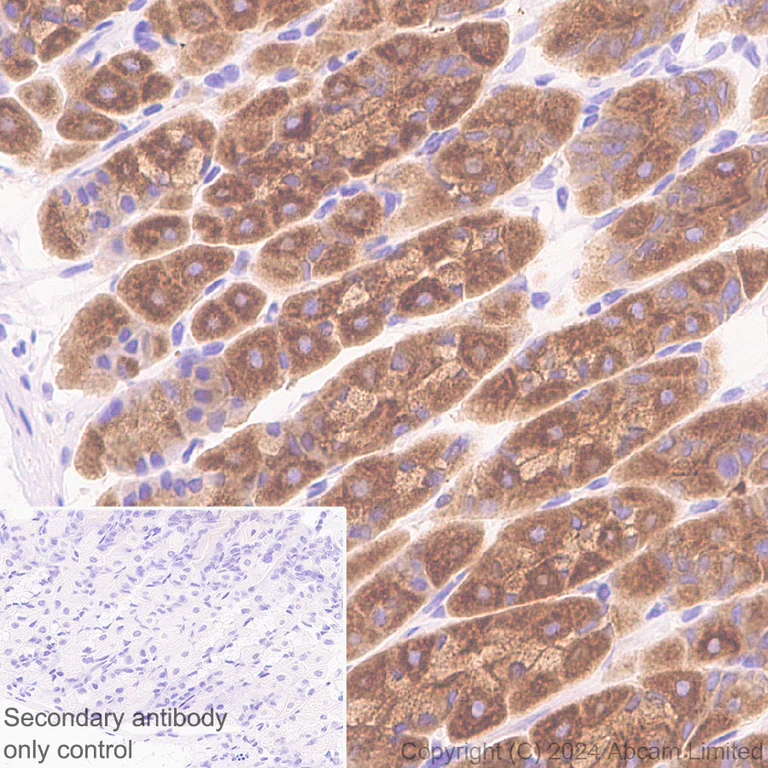 Immunohistochemistry (Formalin/PFA-fixed paraffin-embedded sections) - Anti-RAB27B antibody [EPR28647-29] - BSA and Azide free (AB320641)