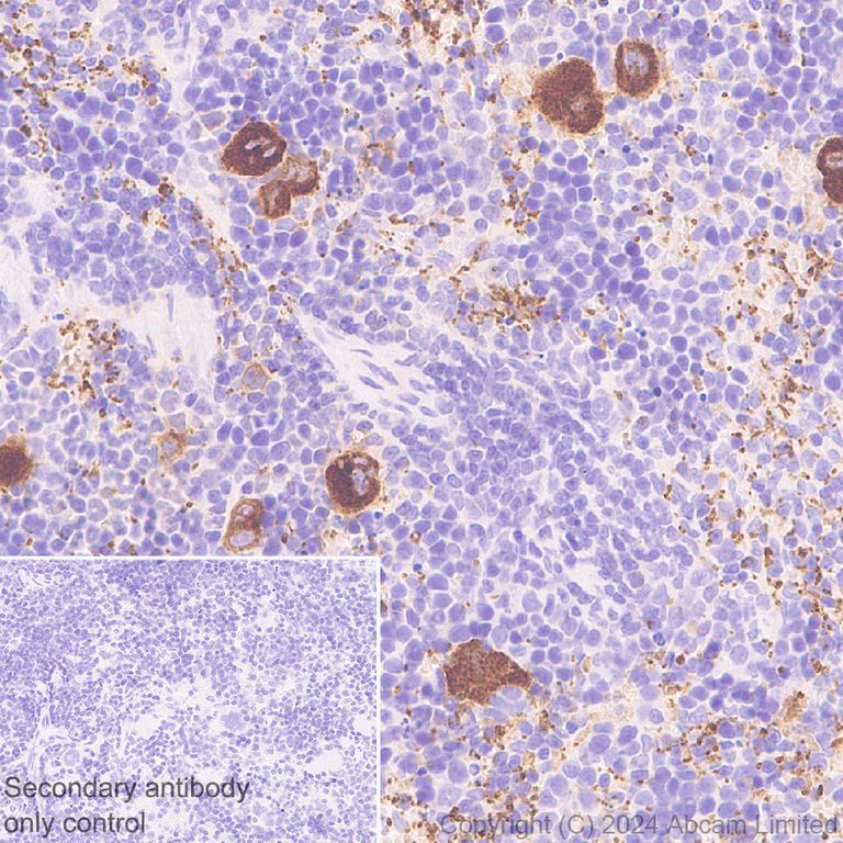 Immunohistochemistry (Formalin/PFA-fixed paraffin-embedded sections) - Anti-RAB27B antibody [EPR28647-29] - BSA and Azide free (AB320641)