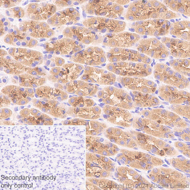 Immunohistochemistry (Formalin/PFA-fixed paraffin-embedded sections) - Anti-RAB27B antibody [EPR28647-29] - BSA and Azide free (AB320641)