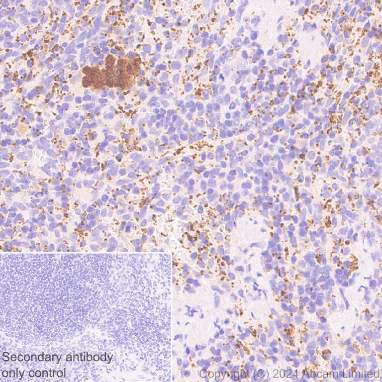 Immunohistochemistry (Formalin/PFA-fixed paraffin-embedded sections) - Anti-RAB27B antibody [EPR28647-29] - BSA and Azide free (AB320641)