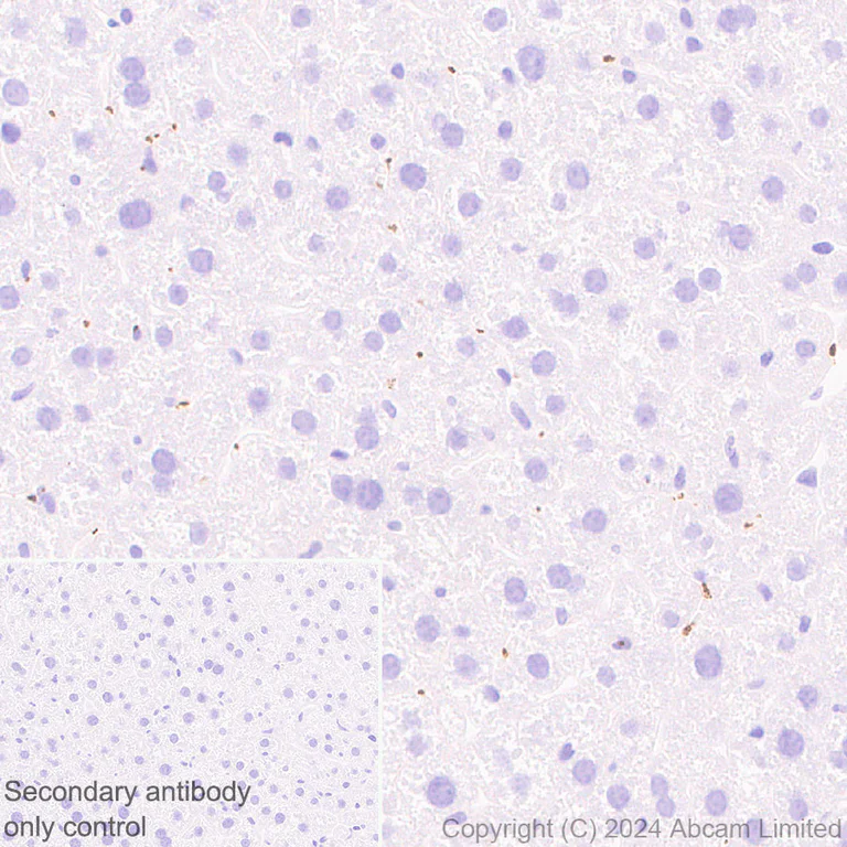 Immunohistochemistry (Formalin/PFA-fixed paraffin-embedded sections) - Anti-RAB27B antibody [EPR28647-29] - BSA and Azide free (AB320641)