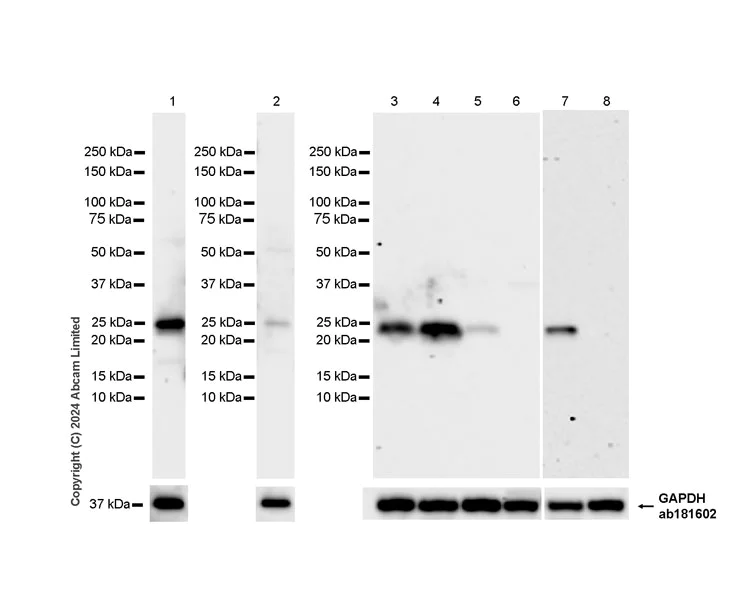 Western blot - Anti-RAB27B antibody [EPR28647-29] - BSA and Azide free (AB320641)