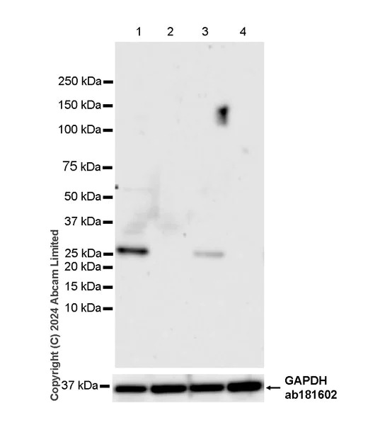 Western blot - Anti-RAB27B antibody [EPR28647-29] - BSA and Azide free (AB320641)