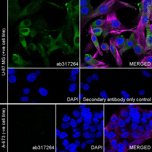 Immunocytochemistry/ Immunofluorescence - Anti-RAB27B antibody [EPR28647-45] (AB317264)