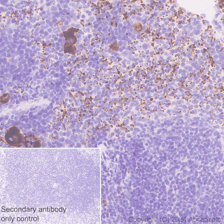 Immunohistochemistry (Formalin/PFA-fixed paraffin-embedded sections) - Anti-RAB27B antibody [EPR28647-45] (AB317264)