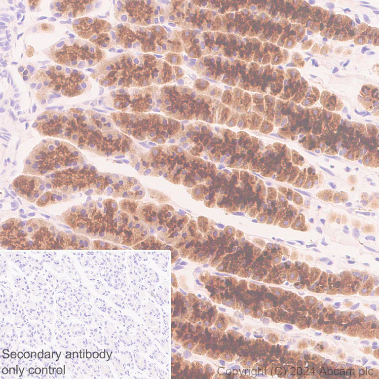 Immunohistochemistry (Formalin/PFA-fixed paraffin-embedded sections) - Anti-RAB27B antibody [EPR28647-45] (AB317264)