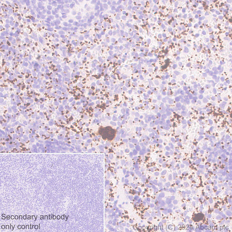 Immunohistochemistry (Formalin/PFA-fixed paraffin-embedded sections) - Anti-RAB27B antibody [EPR28647-45] (AB317264)