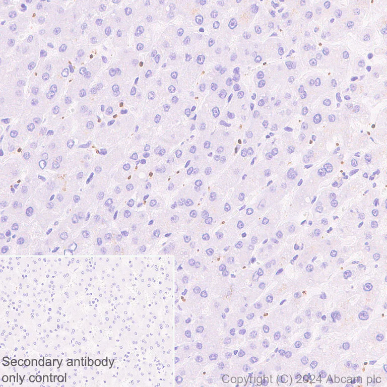Immunohistochemistry (Formalin/PFA-fixed paraffin-embedded sections) - Anti-RAB27B antibody [EPR28647-45] (AB317264)