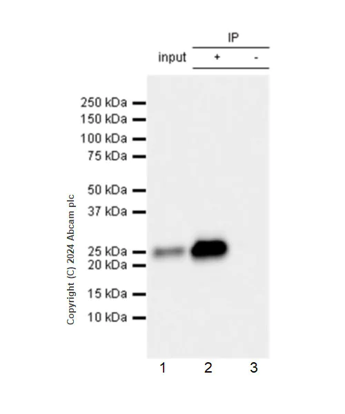 Immunoprecipitation - Anti-RAB27B antibody [EPR28647-45] (AB317264)