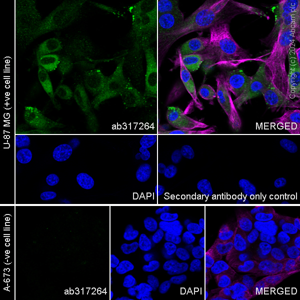 Immunocytochemistry/ Immunofluorescence - Anti-RAB27B antibody [EPR28647-45] - BSA and Azide free (ab317265), expandable thumbnail