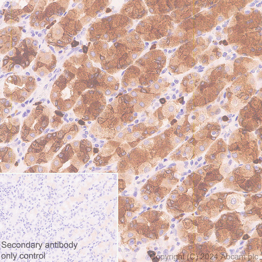 Immunohistochemistry (Formalin/PFA-fixed paraffin-embedded sections) - Anti-RAB27B antibody [EPR28647-45] - BSA and Azide free (ab317265), expandable thumbnail