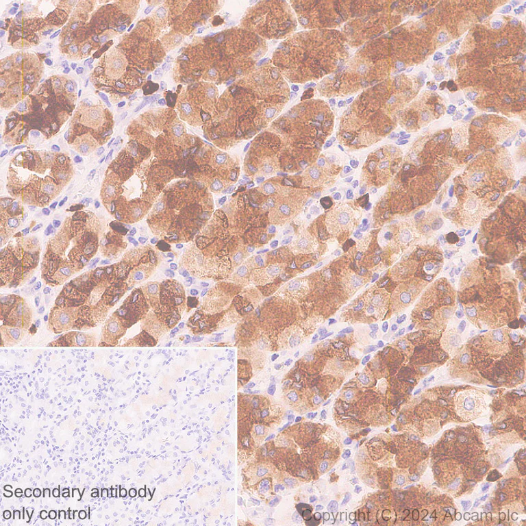 Immunohistochemistry (Formalin/PFA-fixed paraffin-embedded sections) - Anti-RAB27B antibody [EPR28647-45] - BSA and Azide free (AB317265)