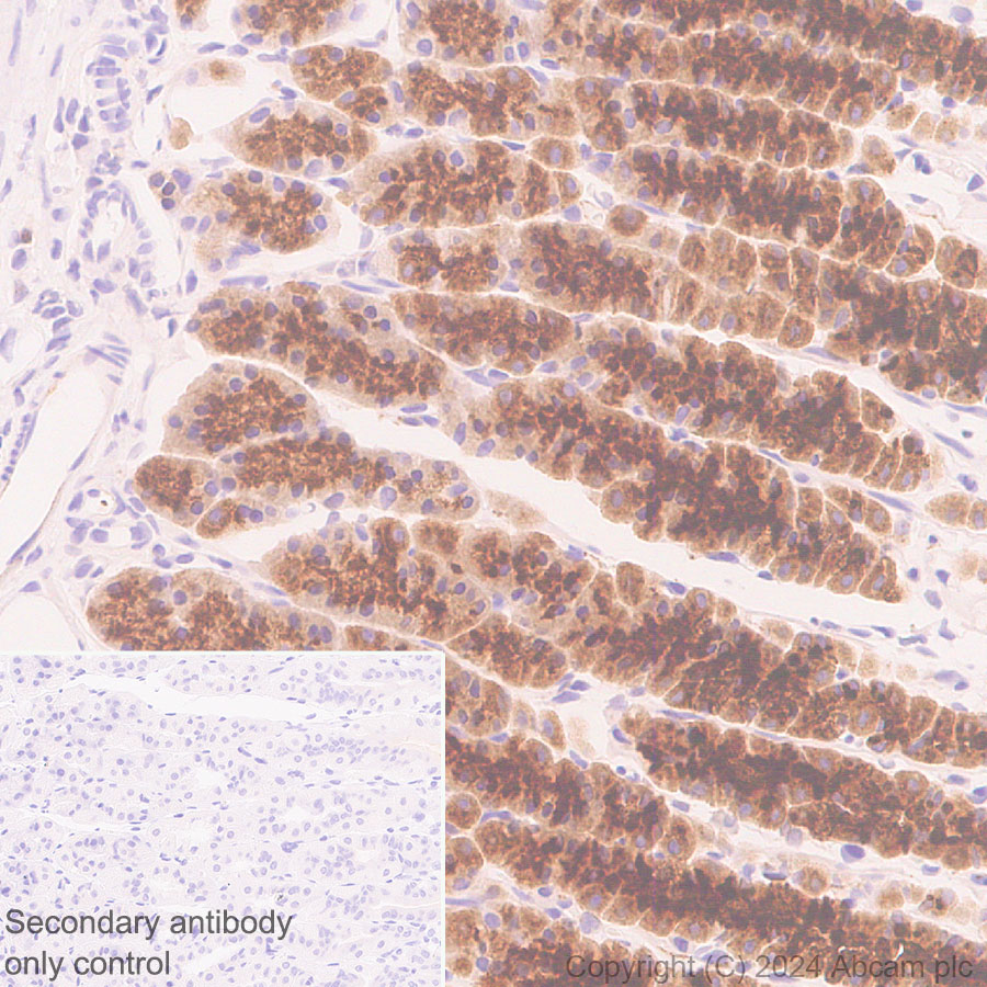 Immunohistochemistry (Formalin/PFA-fixed paraffin-embedded sections) - Anti-RAB27B antibody [EPR28647-45] - BSA and Azide free (ab317265), expandable thumbnail