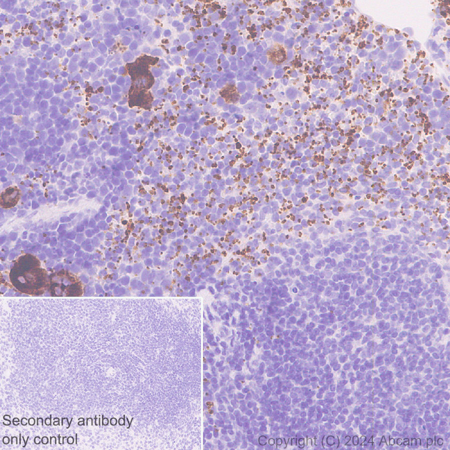 Immunohistochemistry (Formalin/PFA-fixed paraffin-embedded sections) - Anti-RAB27B antibody [EPR28647-45] - BSA and Azide free (ab317265), expandable thumbnail