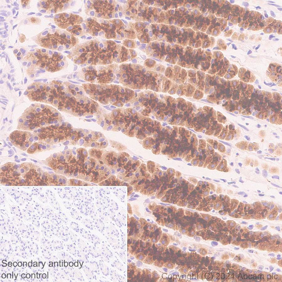 Immunohistochemistry (Formalin/PFA-fixed paraffin-embedded sections) - Anti-RAB27B antibody [EPR28647-45] - BSA and Azide free (ab317265), expandable thumbnail