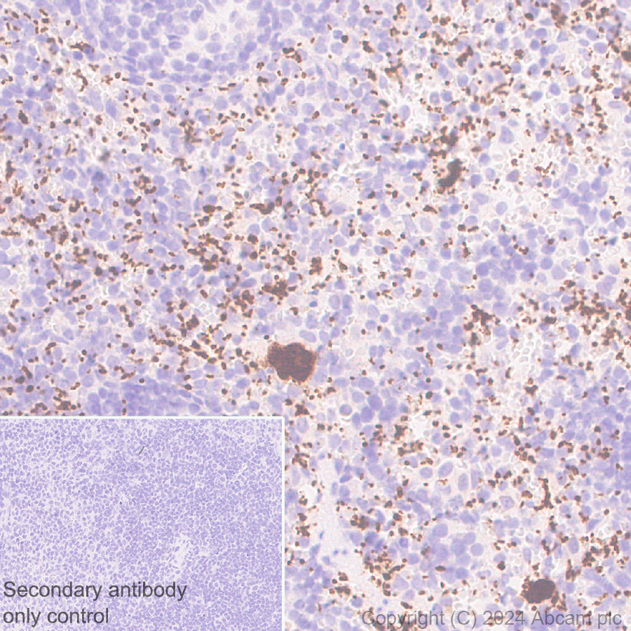 Immunohistochemistry (Formalin/PFA-fixed paraffin-embedded sections) - Anti-RAB27B antibody [EPR28647-45] - BSA and Azide free (ab317265), expandable thumbnail