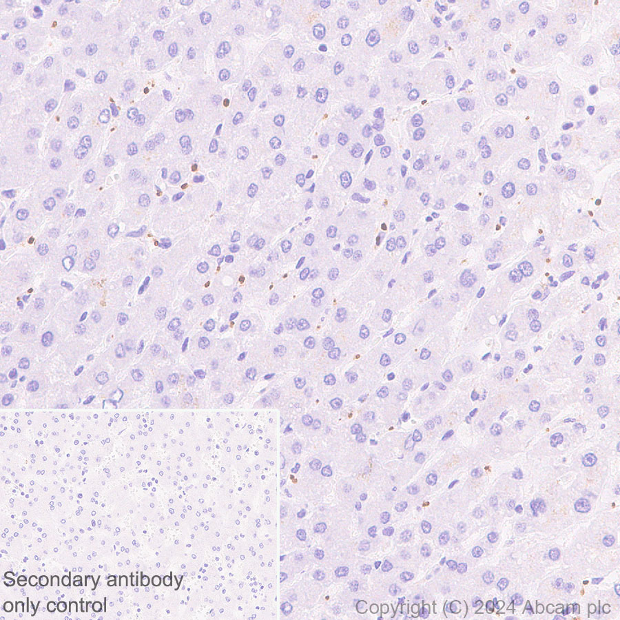 Immunohistochemistry (Formalin/PFA-fixed paraffin-embedded sections) - Anti-RAB27B antibody [EPR28647-45] - BSA and Azide free (AB317265), expandable thumbnail