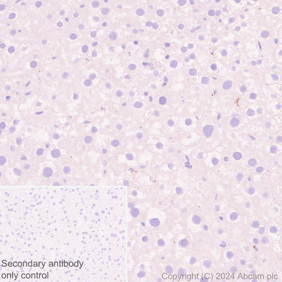Immunohistochemistry (Formalin/PFA-fixed paraffin-embedded sections) - Anti-RAB27B antibody [EPR28647-45] - BSA and Azide free (AB317265), expandable thumbnail