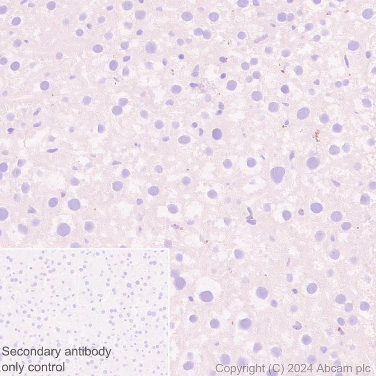 Immunohistochemistry (Formalin/PFA-fixed paraffin-embedded sections) - Anti-RAB27B antibody [EPR28647-45] - BSA and Azide free (AB317265)