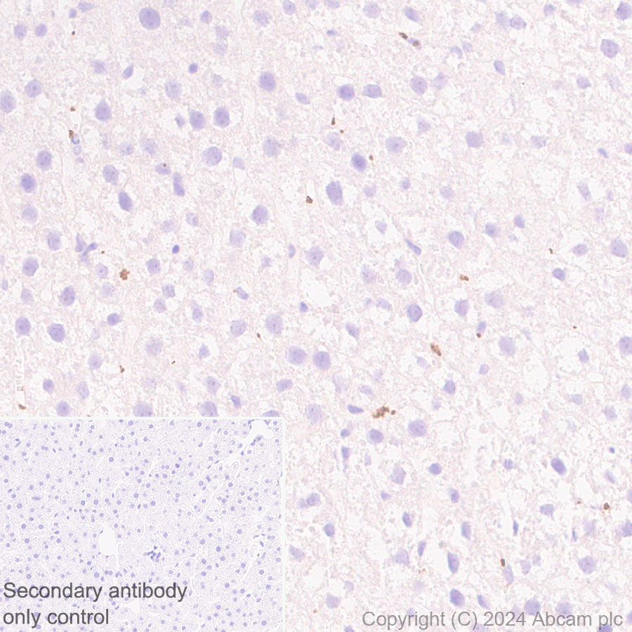Immunohistochemistry (Formalin/PFA-fixed paraffin-embedded sections) - Anti-RAB27B antibody [EPR28647-45] - BSA and Azide free (AB317265), expandable thumbnail