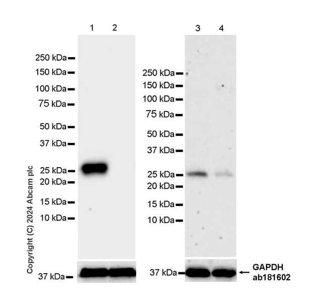 Western blot - Anti-RAB27B antibody [EPR28647-45] - BSA and Azide free (AB317265)