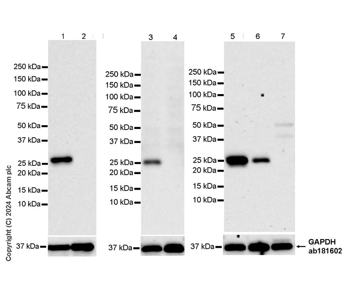 Western blot - Anti-RAB27B antibody [EPR28647-45] - BSA and Azide free (ab317265), expandable thumbnail