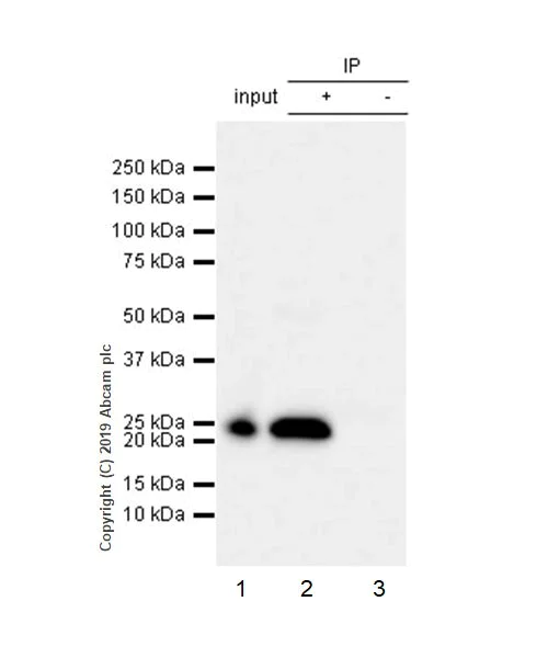 Immunoprecipitation - Anti-RAB29 antibody [MJF-R30-104] (AB256527)