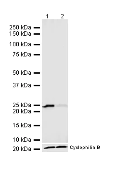 Western blot - Anti-RAB29 antibody [MJF-R30-104] (AB256527)