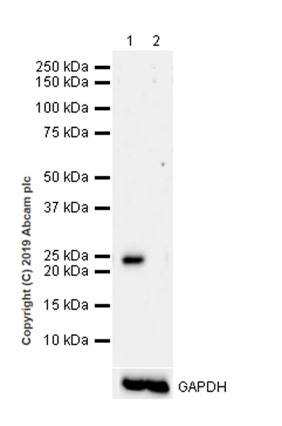 Western blot - Anti-RAB29 antibody [MJF-R30-104] - BSA and Azide free (AB256548)
