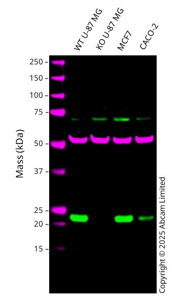 Western blot - Anti-RAB29 antibody [MJF-R30-104] - BSA and Azide free (AB256548), expandable thumbnail