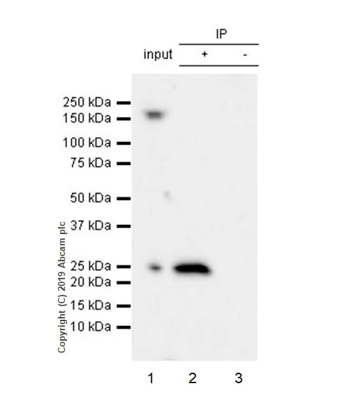 Immunoprecipitation - Anti-RAB29 antibody [MJF-R30-124] (AB256526), expandable thumbnail