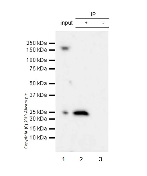 Immunoprecipitation - Anti-RAB29 antibody [MJF-R30-124] (AB256526)