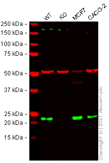 Western blot - Anti-RAB29 antibody [MJF-R30-124] (AB256526), expandable thumbnail