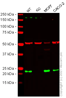 Western blot - Anti-RAB29 antibody [MJF-R30-124] (AB256526)
