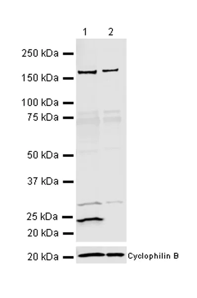 Western blot - Anti-RAB29 antibody [MJF-R30-124] (AB256526)